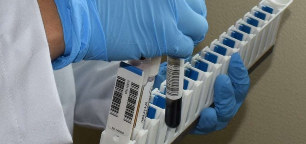 Allanan tres locales del Ministerio de Salud por caso de pruebas de VIH-Sida